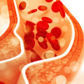 Lowering Cholesterol: A Comprehensive Overview